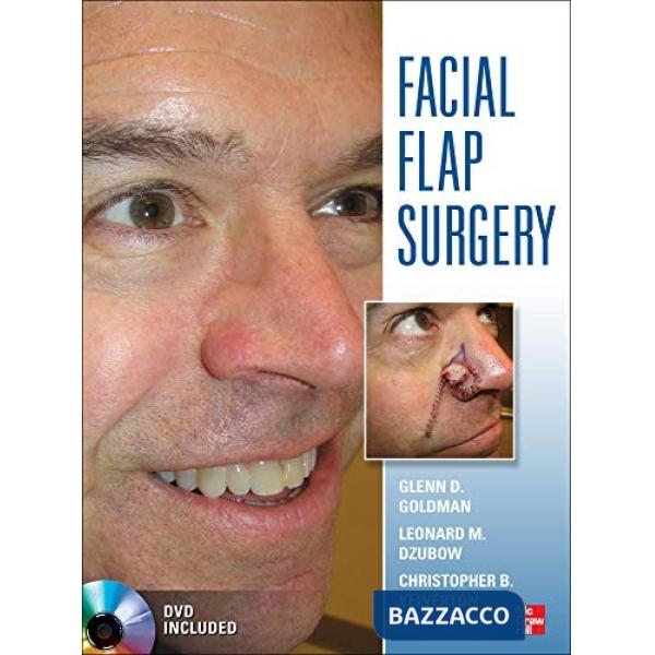 Facial flaps surgery. Con DVD