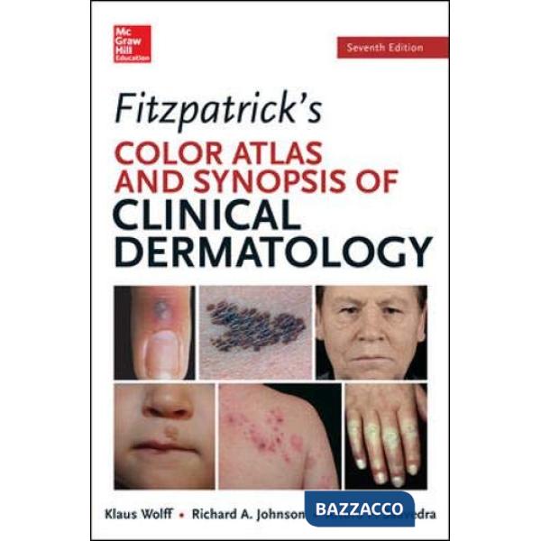 Fitzpatrick's color atlas & synopsis of clinical dermatology