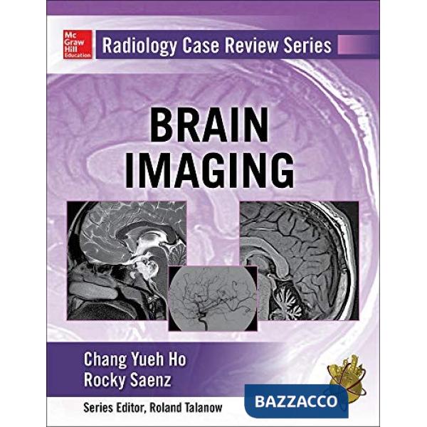 Radiology case review series: brain imaging