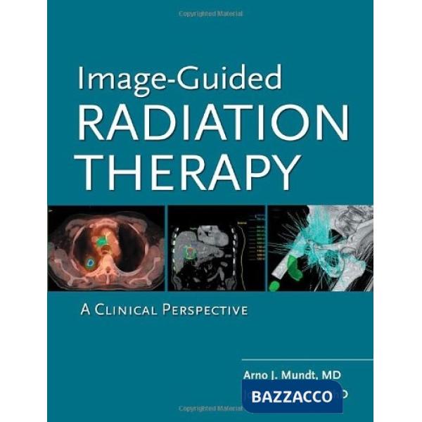 Image guided radiation therapy