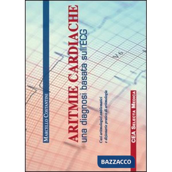 ARITMIE CARDIACHE (SEL)