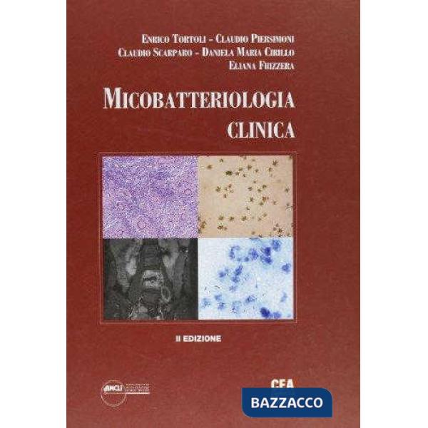 MICOBATTERIOL CLIN + CDR (CEA)