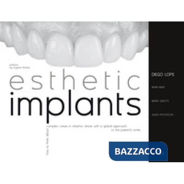 Esthetic implants. How to think about complex cases in anterior areas with a global approach to the patient' s smile