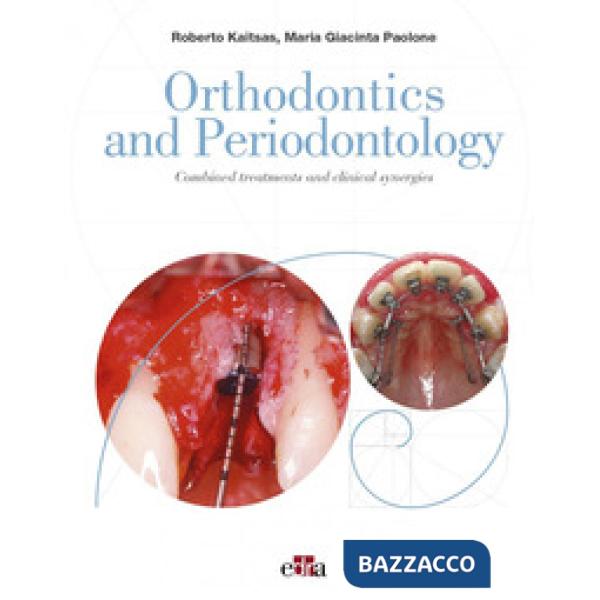 Orthodontics and Periodontology. Combined treatments and clinical synergies