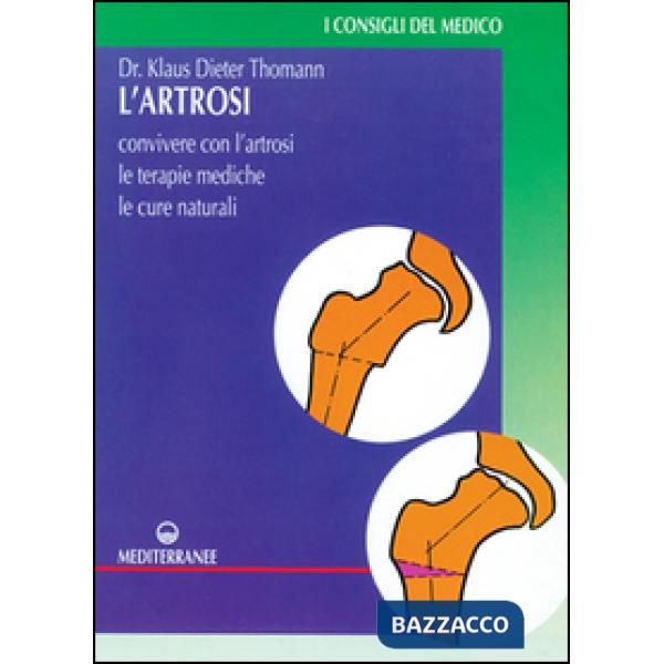 Artrosi. Come convivere con l'artrosi. Le terapie mediche, le cure individuali (L')