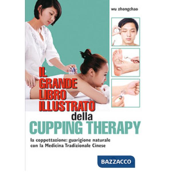 Grande libro illustrato della cupping therapy. La coppettazione: guarigione naturale con la Medicina Tradizionale Cinese (Il)