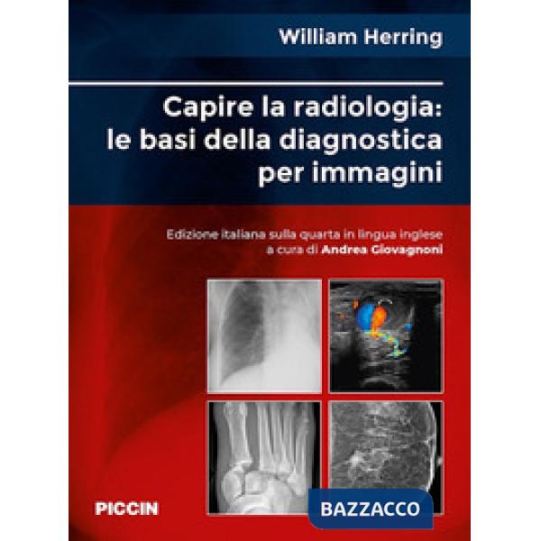 Capire la radiologia: le basi della diagnostica per immagini