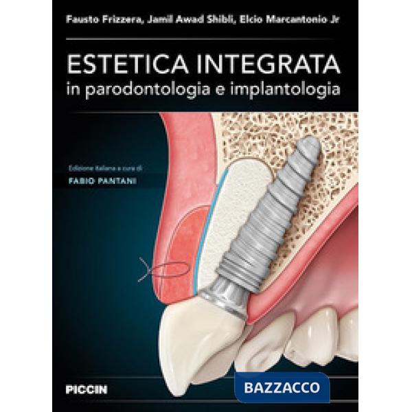 Estetica integrata in parodontologia e implantologia