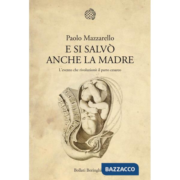 E si salvò anche la madre. L'evento che rivoluzionò il parto cesareo