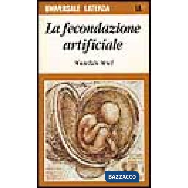 Fecondazione artificiale (La)