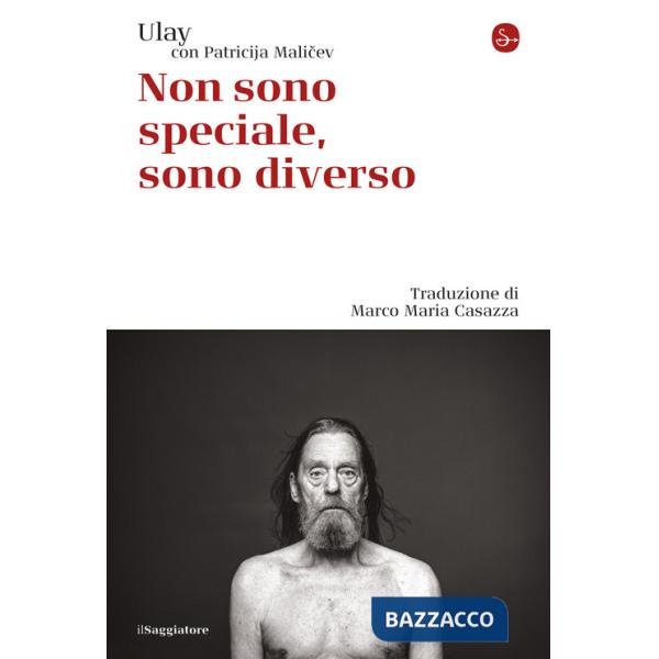 Non sono speciale, sono diverso