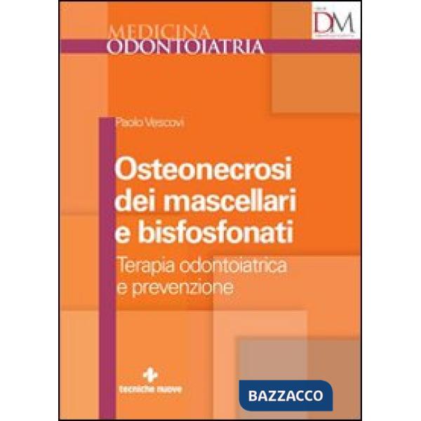 Osteonecrosi dei mascellari e bisfosfonati