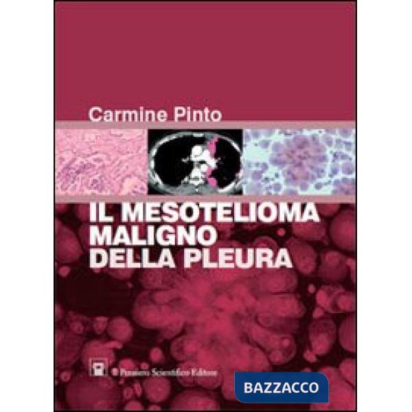 Mesotelioma maligno della pleura (Il)