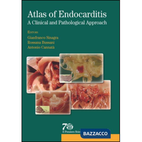 Atlas of endocarditis. A clinical e pathological approach