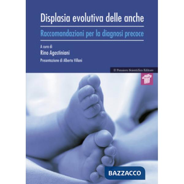 Displasia evolutiva delle anche. Raccomandazioni per la diagnosi precoce