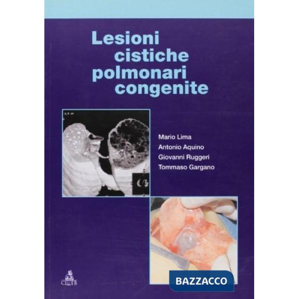 Lesioni cistiche polmonari congenite