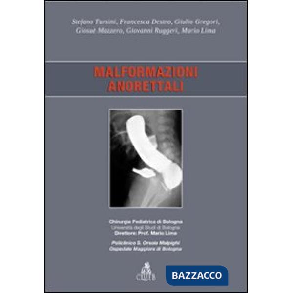 Malformazioni anorettali