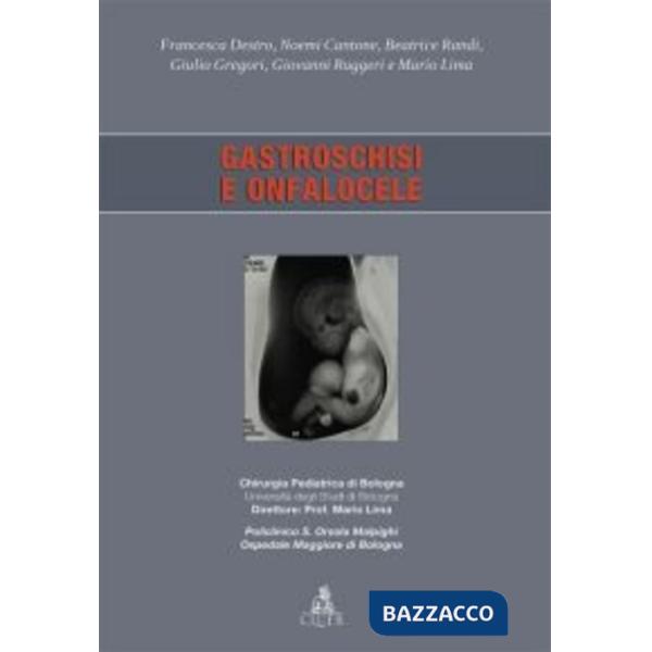Gastroschisi e onfalocele