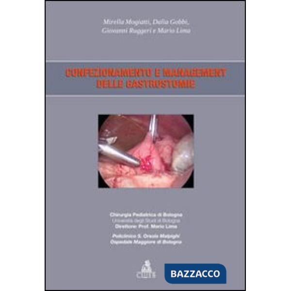 Confezionamento e management delle gastrostomie