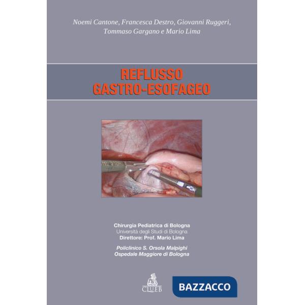 Reflusso gastro-esofageo