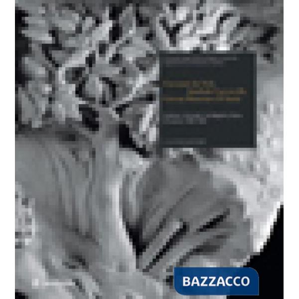 Giovanni da Nola, Annibale Caccavello, Giovan Domenico d'Auria. Sculture ritrova