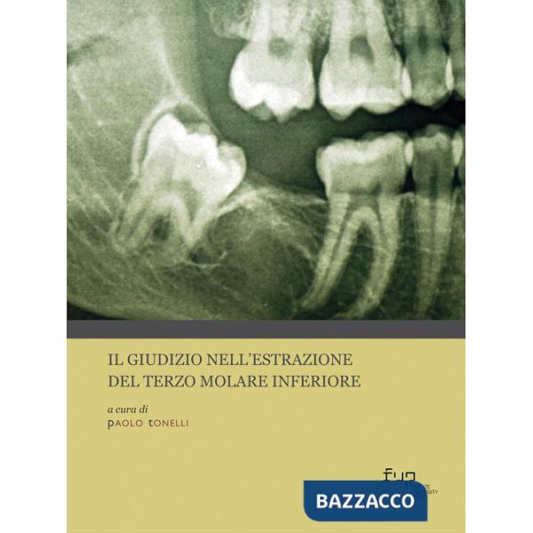 Giudizio nell'estrazione del terzo molare inferiore. Con QR code (Il)