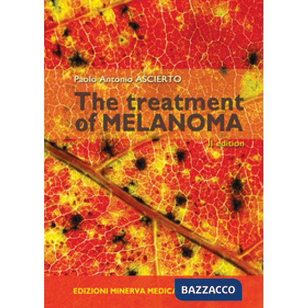 TREATMENT OF MELANOMA