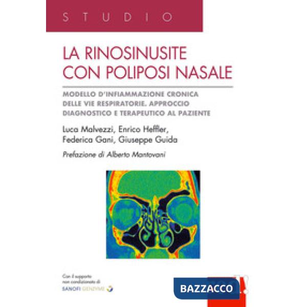 Rinosinusite con poliposi nasale. Modello d'infiammazione cronica delle vie respiratorie. Approccio terapeutico al paziente (La)