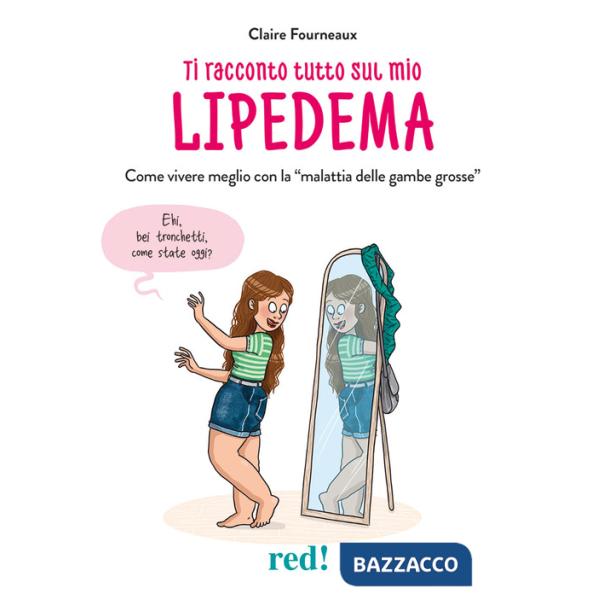 Ti racconto tutto sul mio lipedema. Come vivere meglio con la «malattia delle gambe grosse»