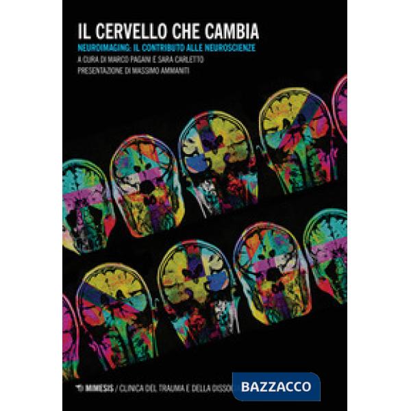 Cervello che cambia. Neuroimaging: il contributo alle neuroscienze (Il)
