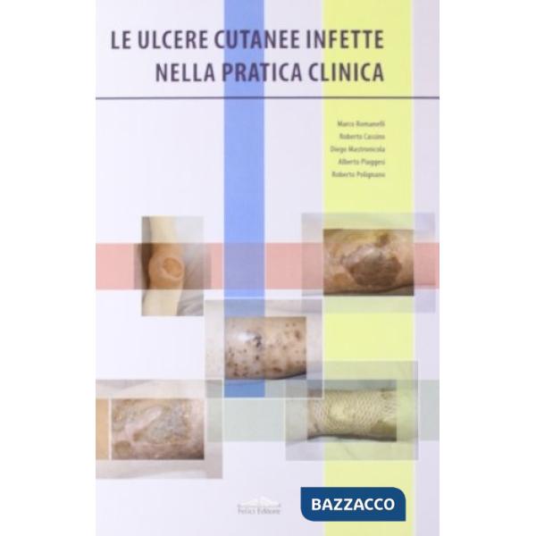 Ulcere cutanee infette nella pratica clinica (Le)