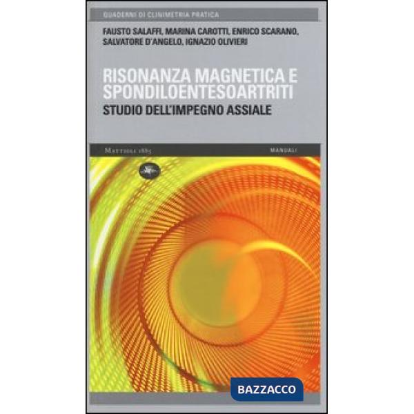 Risonanza magnetica e spondiloentesoartriti