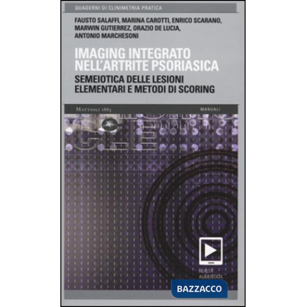 Imaging integrato nell'artrite psoriasica. Semeiotica delle lesioni elementari e metodi di scoring