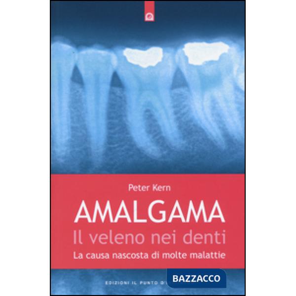 Amalgama. Il veleno nei denti. La causa nascosta di molte malattie