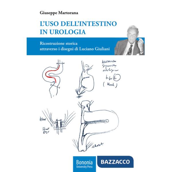 Uso dell'intestino in urologia. Ricostruzione storica attraverso i disegni di Luciano Giuliani (L')