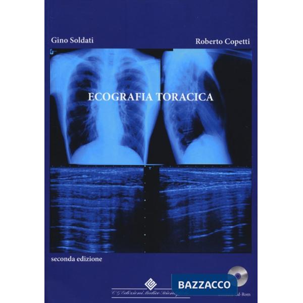 Ecografia toracica. Con CD-ROM