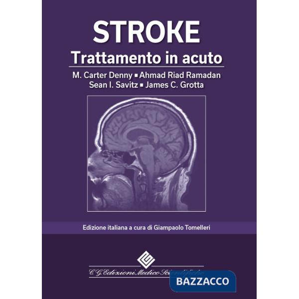 Stroke. Trattamento in acuto