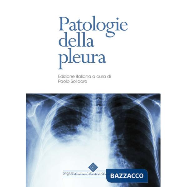 Patologie della pleura