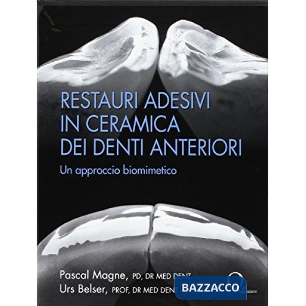 Restauri adesivi in ceramica dei denti anteriori. Un approccio biomimetico