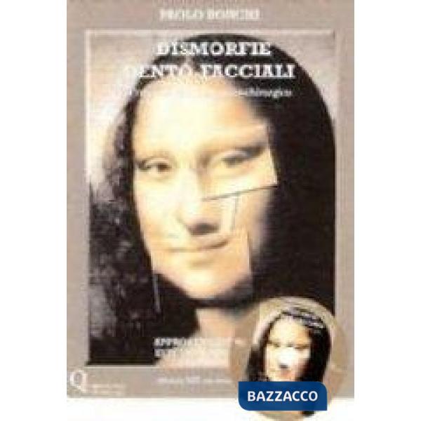 Dismorfie dento-facciali. Trattamento ortodontico-chirurgico. Con DVD
