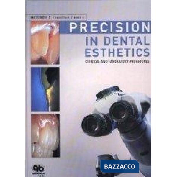 Precision in dental esthetics. Clinical and laboratory procedures