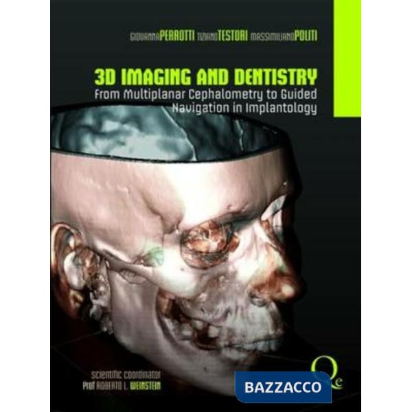 3D imaging and dentistry from multiplanar cephalometry to guided navigation in implantology