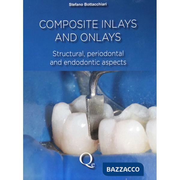 Composite inlays and onlays