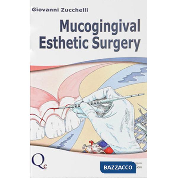 Mucogingival esthetic surgery