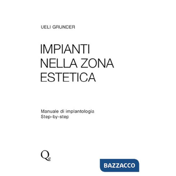 Impianti nella zona estetica. Manuale di implantologia step by step
