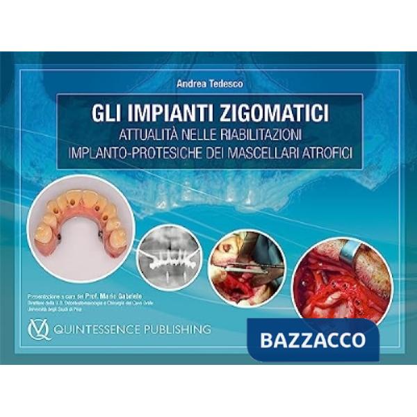 Impianti zigomatici. Attualità nelle riabilitazioni implanto-protesiche dei mascellari atrofici (Gli)