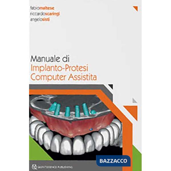 Manuale di implanto-Protesi computer assistita