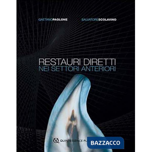 Restauri diretti nei settori anteriori