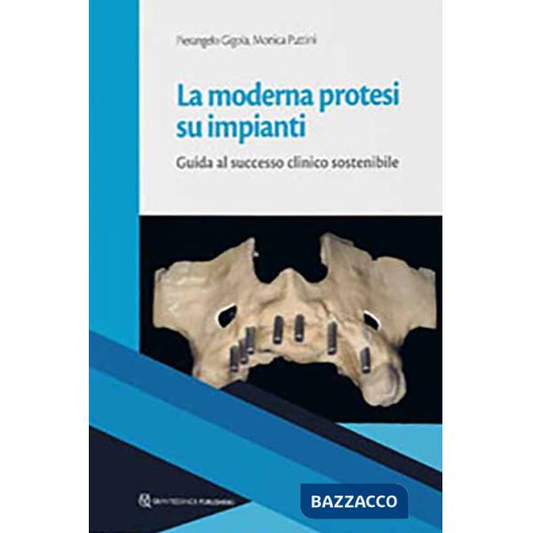 Moderna protesi su impianti. Guida la successo clinico sostenibile (La)