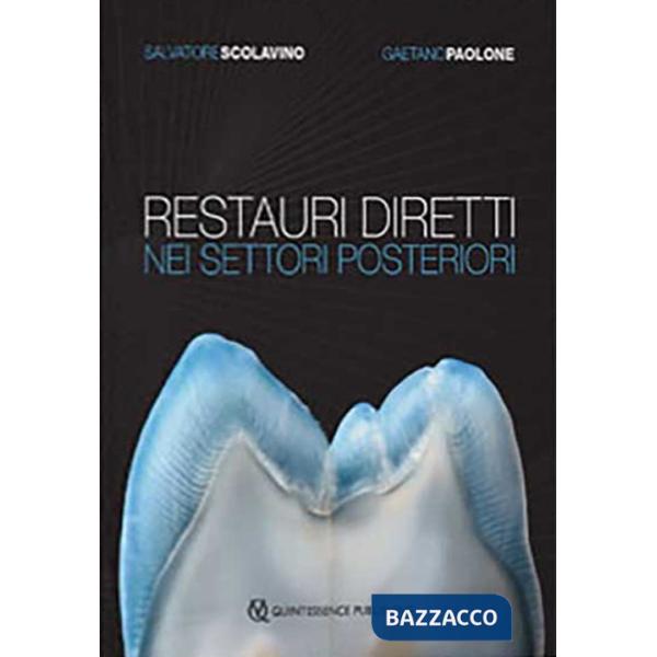 Restauri diretti nei settori posteriori